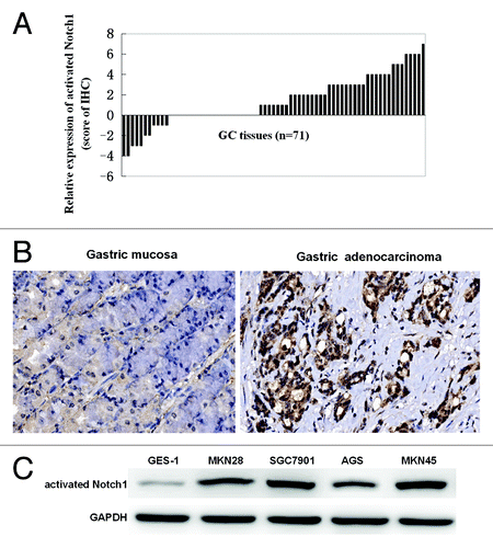 Figure 1. Analysis of activated Notch1 expression in human GC tissues and cells. Immunohistochemical staining for activated Notch1 in gastric adenocarcinoma and their normal counterparts (n = 71) was detected using polyclonal antibody to human activated Notch1 (1:200 dilution). The results of immunohistochemical staining for activated Notch1 were scored and relative expression of activated Notch1 in 71 primary gastric cancer tissues compared with their pair-matched adjacent non-tumor tissues were illustrated (A). The histograms above the x-axis means positive expression of activated Notch1. The brown signals represent positive staining for activated Notch1 (original magnifications ×200) (B). Activated Notch1 expression levels in the cellular total protein were determined by western blotting. Each blot was stripped after being detected with activated Notch1 and reprobed with GAPDH to ensure equal protein loading (C). Band densities were normalized to GAPDH. Intensities of the immunoreactive bands were quantified by densitometric scanning.