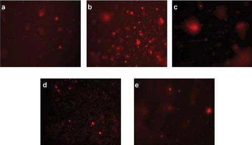 Figure 3. Visual DNA damage human lymphocytes treated with different concentrations of ethanolic extract of A. roseum. (a) 16 mg/ml: (b) 8 mg/ml: (c) 4 mg/ml: (d) 0.061 mg/ml and (e) 0.03 mg/ml.
