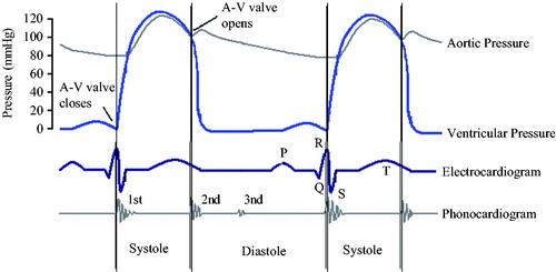 Figure 1. Relationship between ECG, aortic pressure, and heart sound signal at ventricular pressure.