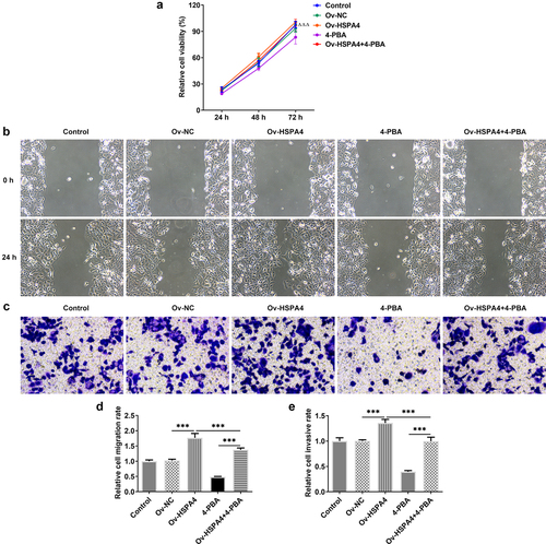 Figure 6. HSPA4 overexpression promotes cell viability, migration and invasion in TNBC cells. (a) Cell viability was detected by CCK-8 assay. ΔΔΔP < 0.05 versus 4-PBA. (b) and (d), Wound healing assay was performed to assess cell migration. Original magnification 100 ×. (c) and (e), Cell invasion was evaluated by transwell assay. Original magnification 100 ×. Data are expressed as mean ± SD. ***P < 0.001.