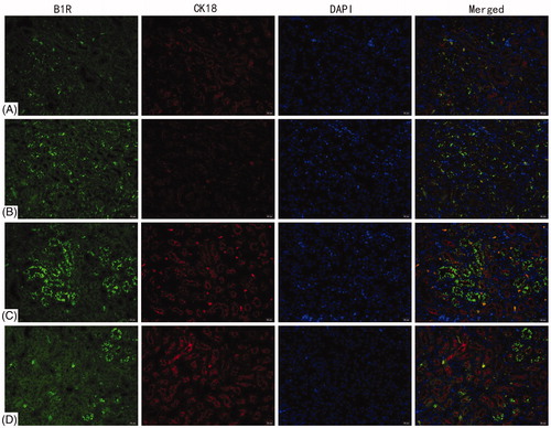 Figure 3. Deposition of B1R on renal tubules. B1R detected by double immunofluorescence staining with CK18. (A) Blank control, (B) vehicle control, (C) 72 h TCE+, and (D) 72 h TCE− group. Magnification =400×. Representative photos are shown.