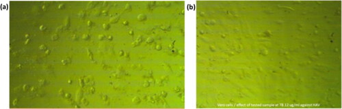 Figure 5. Effect of (a): HAV, and (b) 78.125 µg/mL SNPs@AC composite on VERO cell line (ATCC ccl-81).