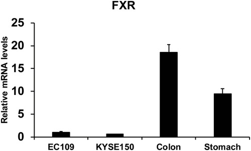 Figure 1 FXR levels of human colon (n=8), stomach issue (n=8), EC109 cells and KYSE150 cells were quantified.