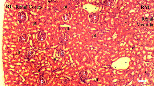 Figure 5 Representative light microscopy of kidney tissue from the control group. Normal kidney tissue.