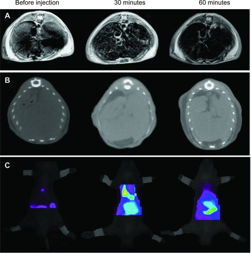 Figure 6 In vivo imaging of i-fmSiO4@SPIONs.Notes: (A) T2-weighted MR, (B) CT, and (C) fluorescence images of mouse livers after the intravenous injection of i-fmSiO4@SPIONs at different periods of time postinjection.Abbreviations: i-fmSiO4@SPIONs, iodinated oil-loaded fluorescent mesoporous silica-coated superparamagnetic iron oxide nanoparticles; MR, magnetic resonance; CT, computed tomography.
