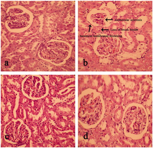 Figure 3. H & E staining of kidney sections of (a) control; (b) diabetic control; (c) diabetic treated with 200 mg kg−1 of EEFSB; (d) diabetic treated with 400 mg kg−1 of EEFSB. The images were taken under ×400 magnifications.