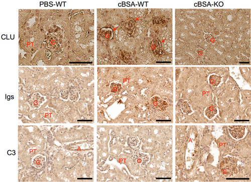 Figure 4 The glomerular deposit of Igs and C3 in mice after cBSA immunization in CLU-KO mice. The glomerular expression of CLU, Igs or C3 was detected by using immunohistochemical staining. Upper panel: CLU protein. Red arrow: capsular epithelium. Middle panel: Igs. Bottom panel: C3. G: glomerulus, PT: proximal tubule, A: artery. Data are presented in a typical microscopic image of immunohistochemical staining of each target protein. Brown color: positive staining. Scale bar: 80 µm.