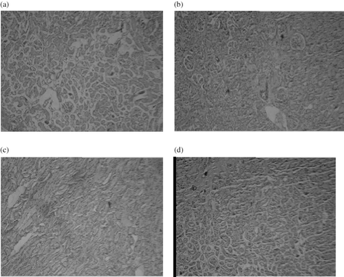 Figure 6. Microscopic observations of kidneys tissue sections of rats subjected to 45-minute ischemia and 24 hours reperfusion, before and after treatment with nebivolol with BIOXL light microscope showing morphological changes. Images were taken under light microscopy using hematoxylin and eosin (×10). (a) Sham, (b) I/R, (c) I/R+L-NAME, (d) I/R+L-NAME+Neb.