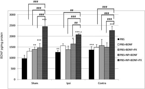 Figure 2. A bar graphs depicting brain-derived neurotrophic factor (BDNF) concentrations (pg/mg protein) measured by enzyme-linked immunosorbent assay (ELISA) in the brain of male C57Bl/6 mice at one hour post-injection of phosphate-buffered saline (PBS); solution of recombinant BDNF in PBS (PBS + BDNF); solution of recombinant BDNF in PBS with poloxamer 188 (PBS + BDNF + PX); suspension of poly(lactic-co-glycolic acid) nanoparticles (NP) with adsorbed BDNF on their surface (PBS + NP + BDNF); suspension of NP with adsorbed BDNF on their surface and coated by poloxamer 188 (PBS + NP + BDNF + PX). Sham: left brain hemisphere of sham-operated animals; Ipsi: ipsilateral brain hemisphere of animals with traumatic brain injury (TBI); Contra: contralateral brain hemisphere of animals with TBI. Values are mean ± SD, n = 6; *p < 0.05, **p < 0.01 and ***p < 0.001 versus PBS group; #p < 0.05, ##p < 0.01 and ###p < 0.001 versus PBS + NP + BDNF + PX group. Repeated measures two-way ANOVA with Bonferroni post-hoc analysis. ^p < 0.05, ^^p < 0.01 and ^^^p < 0.001 versus Sham group. Repeated measures one-way ANOVA with Bonferroni post-hoc analysis.