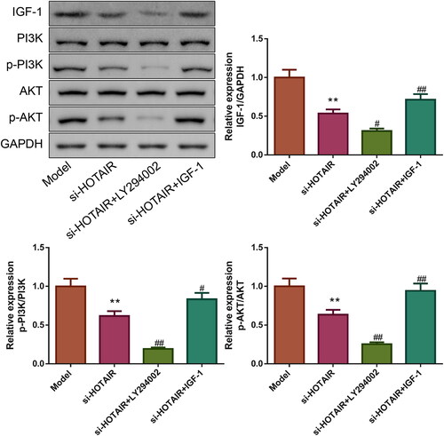 Figure 9. The role of LY294002 and IGF-1 on IGF-1 protein expression and PI3K/Akt pathway. The expression of IGF-1 protein as well as the phosphorylation of PI3K and Akt was measured by western blotting.