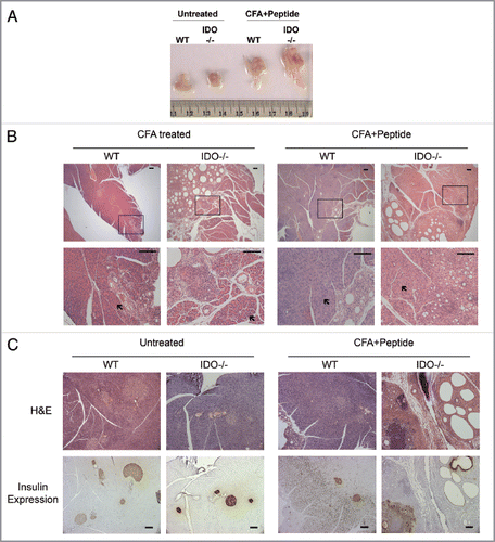 Figure 2 Acute pancreatitis induced by complete Freund's adjuvant in IDO deficient mice. (A) Gross pathology. Freshly dissected pancreata are shown to illustrate the marked increase in organ size produced in mice 28 d after treatment with CFA + peptide (untreated WT n = 5, untreated IDO-/- n = 4, CFA + Peptide treated WT n = 5, CFA + Peptide treated IDO-/- n = 5) (see Material and Methods). (B) Pancreas histology. Representative samples are shown to illustrate pancreatitis that developed after treated with CFA or CFA + Peptide in WT and IDO-/- mice. Lower magnification images are presented in the upper row and boxed areas are magnified in the lower row. Areas indicated by arrows show normal acinar regions of pancreatic tissue. Scale bar = 100 µM. (CFA treated WT n = 5, CFA treated IDO-/- n = 5, CFA + Peptide treated WT n = 5, CFA + Peptide treated IDO-/- n = 5). (C) Insulin expression. Pancreatic tissue sections were stained with H&E for histology or processed for immunohistochemical expression of insulin in islet β-cells. Brown staining demonstrates the presence of insulin containing β-cells in these tissues. Scale bar = 100 µM.