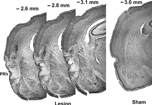 Figure 1 Representative photomicrographs of the rostral perirhinal cortex (area between the black lines) of a neurotoxic and a sham lesioned rat. The extent of the lesion is marked by a dashed line. Coronal brain sections: straight edge is near the mid-line. Abbreviation: PRh, perirhinal cortex.