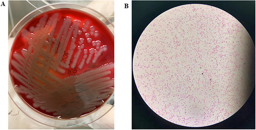 Figure 1 Colony characteristics in blood plate cultured for 24 hours (A) and morphological characteristics were observed under oil microscopy (B) of V. cholerae strain VC1115.