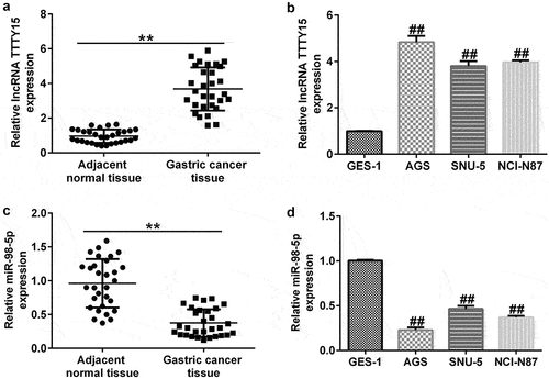 Figure 2. Ectopic expressions of lncRNA TTTY5 and miR-98-5p in gastric cancer tissues and cells.