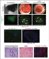Figure 3. Brightfield and fluorescent images of a Pdx1-Cre; YFP pancreatic rudiment at E13 right before implantation (A and A’ respectively); 4 d (B and B’ respectively), and 7 d after implantation (EDF images in C and C’ respectively). (D) Immunofluorescence for Insulin (blue), Glucagon (red) and CP-A (green) on sections from rudiments implanted for 7 d. (E) Immunofluorescence for E-Cadherin (red), the YFP reporter with a DAPI counterstain in a cross-section of the eye with a rudiment from a Pdx-Cre; YFP mouse. (F) Hematoxylin and Eosin stain, (G) Eosin stain and (H) immunofluorescence for Vimentin (red), YFP (green) with a DAPI counterstain on sections from Pdx-Cre; YFP rudiments implanted for 7 d Scale bars=50 μm.