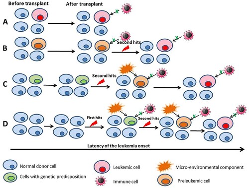 Figure 1. Possible modes of leukemia development in donor cell leukemia. (A) Established leukemic cells are transplanted and the immune surveillance failure. (B) Donor cells acquire the primary mutation before the transplant and the transplanted preleukemic cells acquire the secondary mutations; and the immune cells fail the immune surveillance. (C) Donor cells harbor a genetic predisposition and acquire the secondary mutation after the transplant; micro-environmental and/or the immune surveillance failure. (D) Donor cells after the transplant acquire the primary mutation, acquire the secondary mutation; micro-environmental and/or the immune surveillance failure. The latency period depends on the different modes and the multifactorial processes.