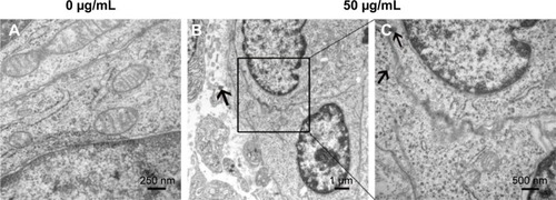 Figure 3 TEM images of BADSCs with and without fullerene-C60 treatment.Notes: (A) Untreated cells. (B) 50 μg/mL fullerene-C60 treated cells. (C) The zoom of selected area in B. The black arrows point to aggregated fullerene-C60 between cells or inside cells.Abbreviations: TEM, transmission electron microscopy; BADSCs, brown adipose-derived stem cells.