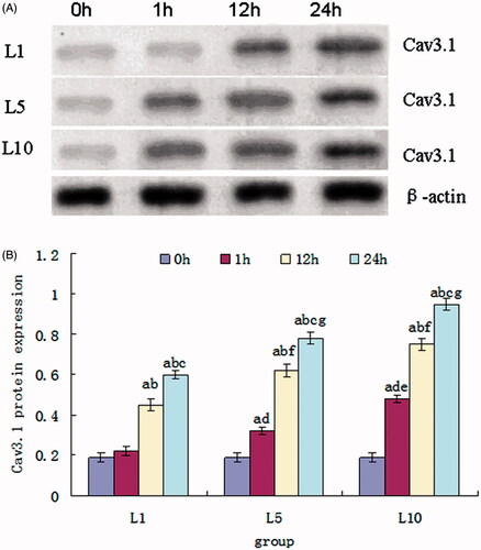Figure 5. Cav3.1 protein expression of the SH-SY5Y cells treated with 1, 5 and 10 mM lidocaine hydrochloride (mean ± sd, n = 6). (A) Represents band of the Cav3.1 protein and β-actin. (B) Comparison among the groups, ap < .05 versus 0 h, bp < .05 versus 1 h, cp < .05 versus 12 h; comparison in intergroups, dp < .05 versus 1 h of the L1 group, ep < .05 versus 1 h of the L5 group, fp < .05 versus 12 h of the L1 group, gp < .05 versus 12 h of the L5 group.