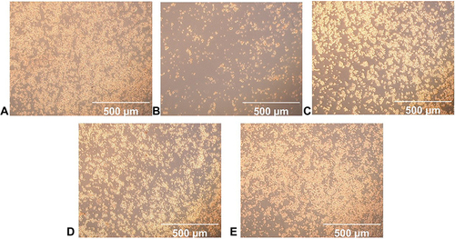 Figure 10 Effects of C60-Oil, on the cell density of HT-29 cells induced with DSS. Cells observed under an inverted electron microscope. (A) untreated cells; (B) cells only stimulated with DSS (10 μg/mL). DSS-stimulated cells after being pretreated with C60-Oil (C) 5 μg/mL; (D) 1 μg/mL; (E) 0.1 μg/mL. Scale bars in the figures indicate 500 μm, magnification 10X.