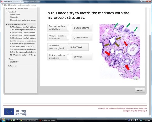 Figure 6 An example of an image-based question on prostate gland pathology in the relevant HIPON chapter.
