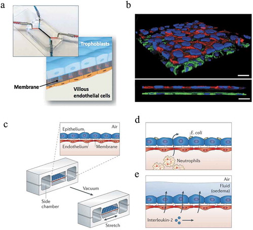 Figure 5. (a) Placenta-on-a-chip, consisting of two microchannels separated by a semipermeable membrane sandwiched between a trophoblast and an endothelial cell monolayer, mimicking the maternal-fetal interface. (b) Three-dimensional rendering (top) and cross-sectional view (bottom) of the bioengineered placental barrier consisting of trophoblast cells cultured on the apical side of the membrane and villous endothelial cells adhering on the basal side of the membrane. Scale bar: 30 μm. Reprinted from reference [Citation81] with permission. Copyright Royal Society of Chemistry (2017). (c) Schematic of a lung-on-a-chip, consisting of an epithelial and endothelial cell monolayer separated by a porous membrane to recapitulate the alveolar-capillary barrier of human lungs. In order to include biomechanical cues, a vacuum was applied to mimic the stretching of the tissue during breathing. The lung-on-a-chip permitted to reconstitute organ-level functions such as (d) the immune response to bacteria and (e) pulmonary edema. Reprinted from reference [Citation89] with permission. Copyright Nature Publishing Group (2015).