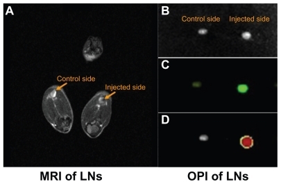 Figure 4 Superparamagnetic iron oxide-enhanced green fluorescent protein-labeled dendritic cells homing to the draining lymph nodes. (A) Labeled DCs homing to the popliteal lymph node by MRI assay in vivo, (B) dissected popliteal lymph node, (C) OPI of popliteal lymph node ex vivo, (D) OPI of popliteal lymph node analyzed using Living Image software.Abbreviations: DCs, dendritic cells; MRI, magnetic resonance imaging; OPI, optical imaging; LN, lymph nodes.