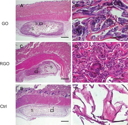 Figure 7 Histological findings at 10 days for implanted GO-coated scaffolds (A and B), RGO-coated scaffolds (C and D), and controls (E and F) implanted into rats: specimen implanted with GO-coated scaffold (A), with inset (b) represented at higher magnification by (B), in which macrophage-like giant cells appear; specimen implanted with RGO-coated scaffold (C), with inset (d) represented at higher magnification by image (D); specimen implanted with collagen scaffold (E), with inset (f) represented at higher magnification by image (F).Notes: Scale bars represent 1 mm (A, C, E), and 50 μm (B, D, F), respectively. Staining is with HE.Abbreviations: GO, graphene oxide; RGO, reduced graphene oxide; Ctrl, control; S, scaffold; HE, hematoxylin eosin.