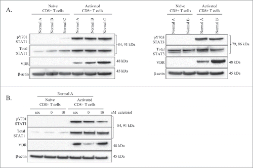 Figure 2. Comparison of VDR and STAT levels in naïve vs. activated normal CD8+ T-cells, and the effects of calcitriol treatment on each cell type. Naïve CD8+ T-cells were isolated from 3 healthy normal donors. One half of each sample was cultured as naïve cells while the other half was activated with PHA for 24 hours. Total loaded protein per sample was 25μg, with β-actin used as a loading control. (A) Western blotting of VDR, STAT1 (pY701, total) and STAT3 (pY705, total) was performed. (B) The naïve and activated cells from Normal Donor #0 were cultured for 24 hours, with or without calcitriol treatment, lysates were probed on a protein gel blot for VDR and STAT1 (pY701, total).