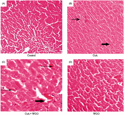 Figure 4. (A) A photomicrography of normal liver tissue (H&E 100). (B) A photomicrography of liver tissue of rats received CsA showing local hepatic area of necrosis (thin arrow) and area with deposition of hemosidrin and inflammatory cells (thick arrow) (H&E 100). (C) A photomicrography of liver tissue for the third group (CsA + WGO) showing improvement at the necrotic areas (thin arrows) and deposition of hyaline material in the central vein (thick arrow) with minimal edema in the hepatic cells (H&E 200). (D) A photomicrography of liver tissue for the fourth group (WGO) showing more or less the normal hepatic architecture without any pathological finding (H&E 200).