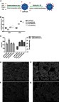 Figure 1 Characterization of AHPP/OVA and surface cationic polymer modified AHPP/OVA. (A) Schematic of OVA-loaded surface cationic polymer modified AHPP/OVA nanoparticles. (B) Loading efficiency of AHPP/OVA and surface cationic polymer modified AHPP/OVA nanoparticle dispersions stored at 37°C. (C) Zeta-potential and particle size of AHPP/OVA, CS-AHPP/OVA, PEI-AHPP/OVA, and εPL-AHPP/OVA. (D–G) SEM of AHPP/OVA, CS-AHPP/OVA, PEI-AHPP/OVA, and εPL-AHPP/OVA. Results were expressed as means ± SEM (n=3). a–b Bars with different superscripts differed significantly (P<0.05).