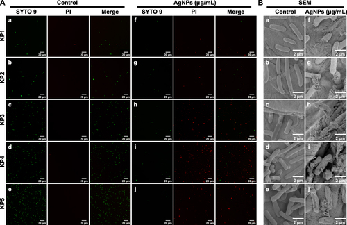 Figure 6 Bactericidal effects of BF75-AgNPs. Images of (A) live/dead cell staining and (B) FE-SEM of five XDR-KP strains treated with the BF75-AgNPs at 1/2 × MIC and ultrapure water for 8 h. The symbols a–e and f–j correspond to the control and AgNPs groups, respectively, for the strains XDR-KP1 through XDR-KP5.