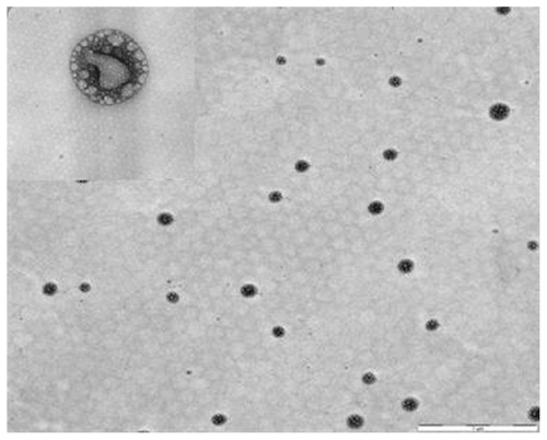 Figure 5 Morphological examinations of BUD-SSMs by transmission electron microscopy.Note: Scale bar = 1 μm and 50 nm.Abbreviation: BUD-SSMs, PEG5000-DSPE polymeric micelles containing budesonide.