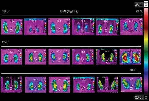 Figure 1. The 18 plantar skin thermograms of the volunteers, arranged as they were taken.
