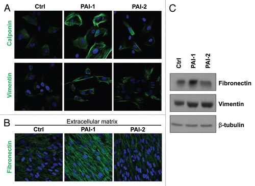 Figure 4 Overexpression of PAI-1 or PAI-2 leads to the upregulation of myofibroblastic markers. To evaluate whether the overexpression of PAI-1 and PAI-2 phenocopy the myofibroblastic phenotype of Cav-1-deficient fibroblasts, the expression of several myofibroblastic markers was assessed in fibroblast control or overexpressing PAI-1 or PAI-2. (A) Localization of calponin (upper parts) and vimentin (lower parts). Note that overexpression of PAI-1 or PAI-2 upregulates the levels of two myofibroblastic markers, calponin and vimentin. Nuclei were immunostained with Hoechst (blue). Images captured at original magnification of 63x. (B) Immunoblotting for vimentin and fibronectin. Note that overexpression of PAI-1 or PAI-2 upregulates vimentin and the overexpression of PAI-1 increases the expression of fibronectin. Immunoblotting with β-tubulin is shown as a control for equal loading. (C) Localization of fibronectin in fibroblast-derived extracellular matrices. Fibroblasts overexpressing PAI-1 or PAI-2 along with controls were plated onto gelatin cross-linked coverslips. Fresh medium containing ascorbic acid was added every other day for 5 d to induce extracellular matrix production. Then, the cells with their matrices were fixed and immunostained with an antibody against fibronectin. Note that PAI-1 overexpression increases fibronectin deposition, a myofibroblastic marker. Nuclei were counterstained with Hoechst (blue). Images captured at original magnification of 63x. Ctrl, fibroblasts containing empty vector alone; PAI-1, fibroblasts overexpressing PAI-1; PAI-2, fibroblasts overexpressing PAI-2.