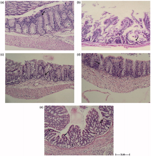 Figure 5. Histology of small intestine due to the treatments. A representative micrograph from a mouse in each regimen is shown. (a) Naïve control showing normal mucosa. (b) CTX only (25 mg/kg BW) showing necrosis with damaged crypt architecture. (c) A. ferruginea extract (10 mg/kg BW) + CTX showing normal muscularis propria. (d) MESNA (25 mg/kg BW) + CTX with randomly damaged architecture. (e) Extract only showing normal architecture. All treatments were by IP injection of each treatment agent daily for 10 consecutive days. In the groups that received CTX or extract only, the volume of any missing component from the co-treatment groups was replaced by gum acacia-PBS injection so that all mice received the same volumes of injection each day. Magnification = 40×.