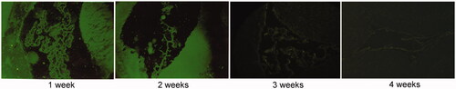 Figure 1. The expression of green fluorescent protein in the lateral intraventricular region in AdHIF-1α group (×200). The expression of green fluorescent protein was observed in the lateral ventricular wall, ependymal epithelium and choroid plexus.