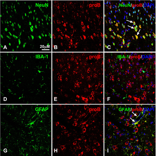 Figure 2 Double labeling of proBDNF with NeuN, GFAP or IBA-1 in the spinal cord after CFA intraplantar injection at day 1. (A–C) Double staining of NeuN (green, (A)) and proBDNF (red, (B)) in the ipsilateral spinal cord at CFA intraplantar injection at day 1. Arrows indicate co-localization of proBDNF and Neun. (D–F) Representative confocal microscopy images of proBDNF (red, (E)) with Iba1 (green, (D)). (G–I) Representative immunofluorescence images showing double labelling of proBDNF (red, (H)) with GFAP (green, (G)) in spinal cord. Arrows indicate co-localization of proBDNF and GFAP. Scale bars= 20 µM.