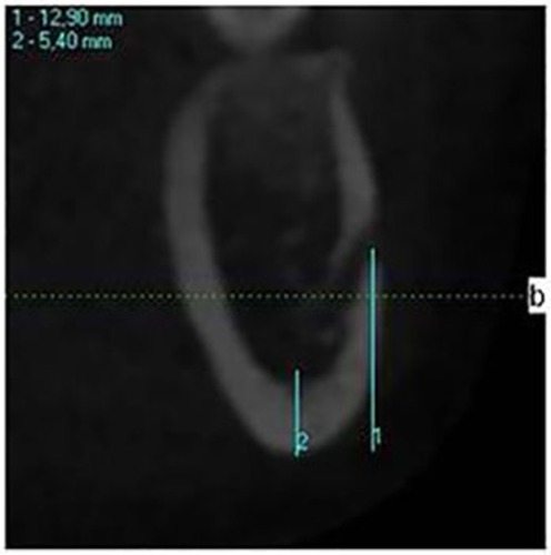 Figure 2 DVT-MI measurement: 1-MFU, 2-BMC.