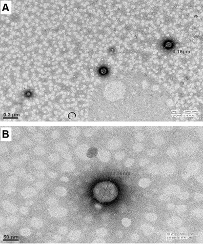 Figure 3 TEM images of optimized formulation at (A) 9900× resolution showing the particle size 160 nm, (B) 38000× resolution showing the internal architecture of the polymer matrix.