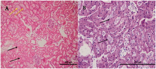 Figure 9. The histopathological evaluation of the renal tissue of NRIR-50 group.