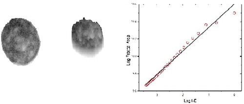 Figure 4. Blast of a patient with acute myeloid leukemia.On the left, cytologic preparation after May-Grünwald-Giemsa staining. Interactive segmentation of the nucleus and transformation into gray values. On the right, Pseudo-3D representation. FD is estimated in the log-log-plot from the slope of the ideal linear regression line obtained by curve fitting. X-axis represents the logarithmic values of the inverse values of the size of the structuring element. The y axis shows the logarithmic values of the intercepts. Goodness-of-fit describes how close the real data points are to the ideal mathematical regression line.