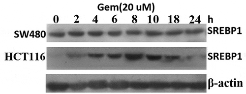 Figure 2. Gem-induced SREBP1 expression in HCT116 and SW480 cells.HCT116 and SW480 cells were treated with 20 uM Gem for 2–24 h, SREBP1 expression was detected by western blot assay.