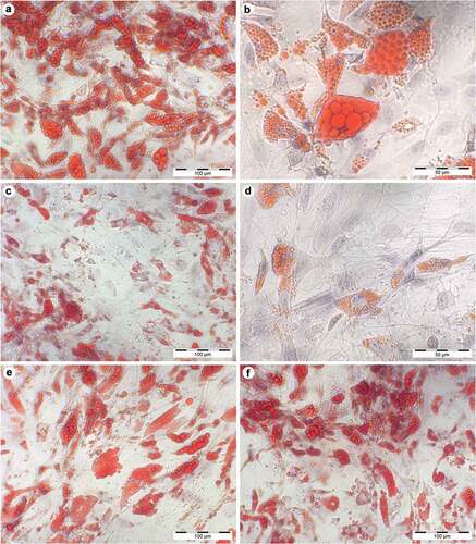 Figure 4. Histological stain after 28 days of differentiation in supplemented adipogenic media. Cultures with fourfold glucose (4G: a, b) and fourfold insulin (4I: c, d) concentrations at 20x (a, c; scale bar: 100 µm) and 40x magnification (b, d; scale bar: 50 µm). Standard differentiation (e) and mannitol treatment as an osmotic control for 4G (f) are presented at 20x magnification. Lipid-containing vacuoles were visualized by Oil-Red-O staining (red), cell nuclei were stained by haematoxylin (blue). Compared to high insulin treated cells, Oil-Red-O stained area was significant higher in fourfold glucose conditions with larger lipid droplets (b) which is characteristic for mature adipocytes.