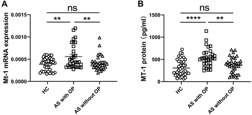 Figure 4 MT-1 mRNA and protein levels in AS patients with or without osteoporosis. The expression of MT1 mRNA (A) and MT1 protein levels in serum (B) were measured in AS patients with OP (n= 31) and without OP (osteoporosis, n= 36) as well as HC (n= 38). Results are showed as mean± SEM. Each symbol represents an individual patient and HC. Horizontal lines indicate median values. Differences between two groups were performed with one-way ANOVA multiple comparisons. **P<0.01; ****P<0.0001.