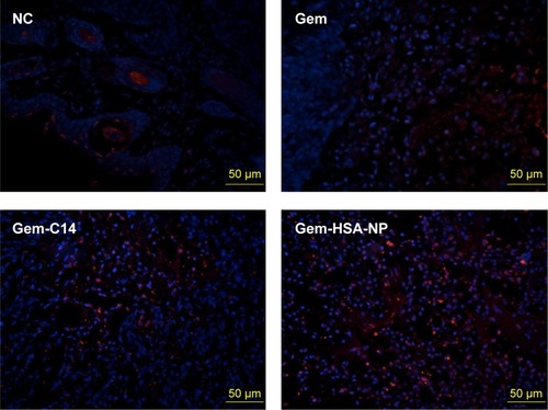 Figure 6 The merged TUNEL stainings showed tumor penetration of drugs on mice bearing subcutaneous pancreatic tumors on day 14 after IV administration.Notes: Frozen sections were examined under a confocal microscope. Nuclei were stained with DAPI (blue), while red represented apoptotic cells. The bar indicated 50 μm.Abbreviations: TUNEL, transferase dUTP nick end labeling; IV, intravenous; DAPI, 4′,6-diamidino-2-phenylindole; NC, negative control; Gem, gemcitabine; Gem-C14, 4-N-myristoyl-gemcitabine; Gem-HSA-NP, gemcitabine-loaded human serum albumin nanoparticle.