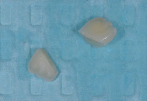 Figure 3 Fractured fragments after cleaning.