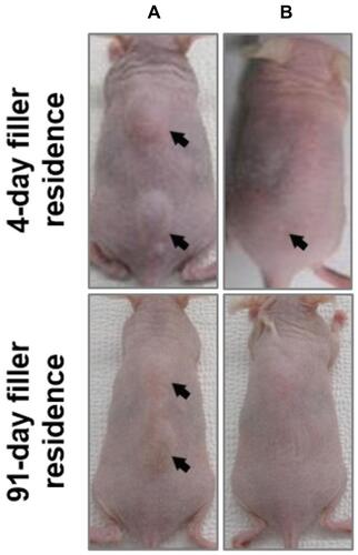 Figure 1 Hyaluronidase-mediated degradation of subcutaneously implanted HA filler. Hairless mice implanted subcutaneously with 0.1 mL NDL. Top and bottom panels show NDL with 4- and 91-day filler residence time, respectively, before (A) and 1 h after hyaluronidase injection (B). Arrows mark the implantation sites showing the surface projection of the HA filler bolus.