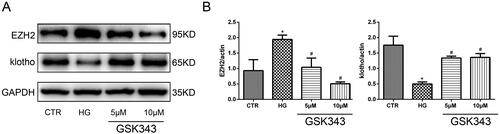 Figure 5. GSK343 restored the expression of EZH2 and klotho induced by high glucose. (A) The expression of EZH2 and klotho stimulated with high glucose in the presence or absence of GSK343 was detected by WB. The results showed that GSK343 could significantly reverse the expression of EZH2 and klotho compared with that in the HG group. (B) Quantitative analysis of the data shown in Panel A (Data are the mean ± SD; *p < .05 vs. CTR group, #p < .05 vs. HG group, n = 3).