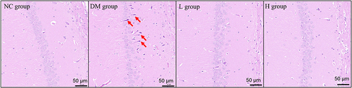 Figure 3 Pathology analysis of the hippocampal tissues in YQBS treated or untreated STZ-induced diabetic rats using H&E staining. The red arrowed indicated the discorded neuronal cells. Scar bar=50µm.