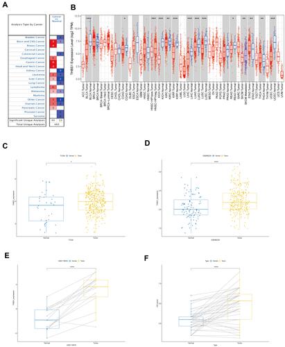 Figure 1 The expression of THBS1 in gastric cancer. (A) THBS1 in different cancers increased or decreased compared with normal tissues in the Oncomine database. (B) The expression of THBS1 in different tumor types by TIMER database. (C) The expression of THBS1 in GC tissues compared with normal tissues in TCGA. (D–E) The expression of THBS1 in GC tissues compared with normal tissues in GSE66229 and GSE118916. (F)The protein expression of THBS1 in GC tissues compared with adjacent normal tissues. * P<0.05, **P<0.01, ***P<0.001, ****P<0.0001.